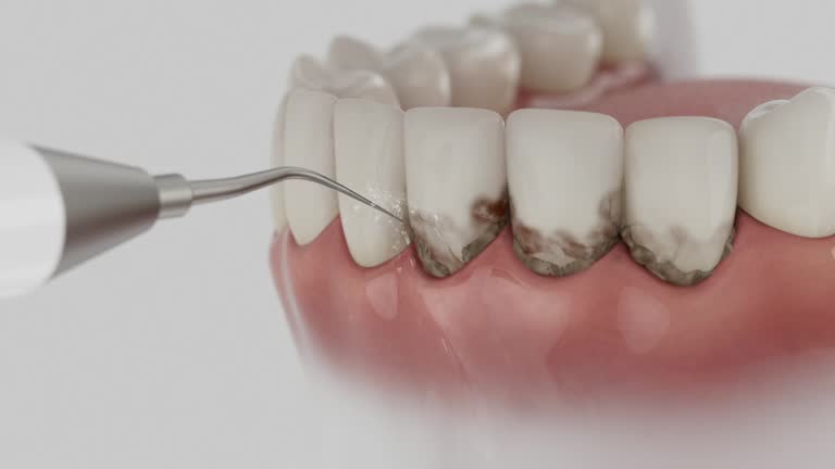 Trusted Tooth Extraction service in Forest Lake, IL - Dentist Open Now